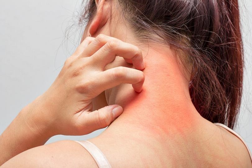 Itchy Skin Causes