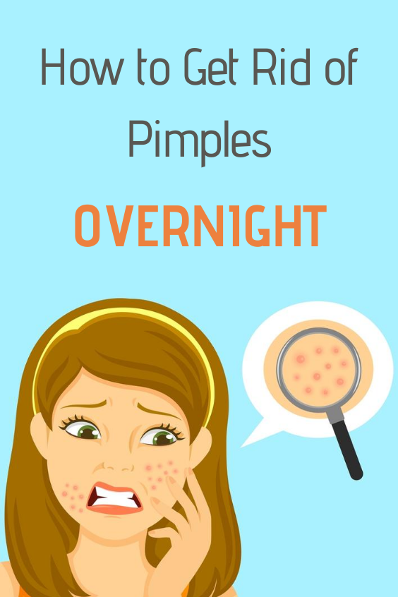 How to Get Rid of Pimples Overnight