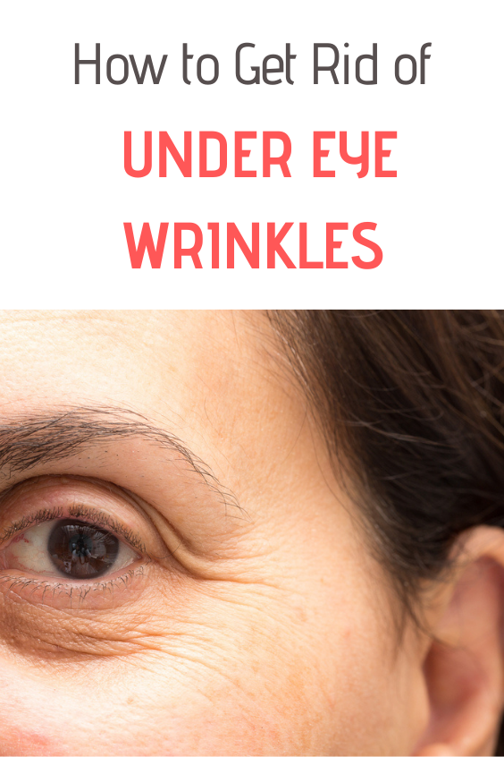 How To Get Rid Of Under Eye Wrinkles Best Tips And Tricks