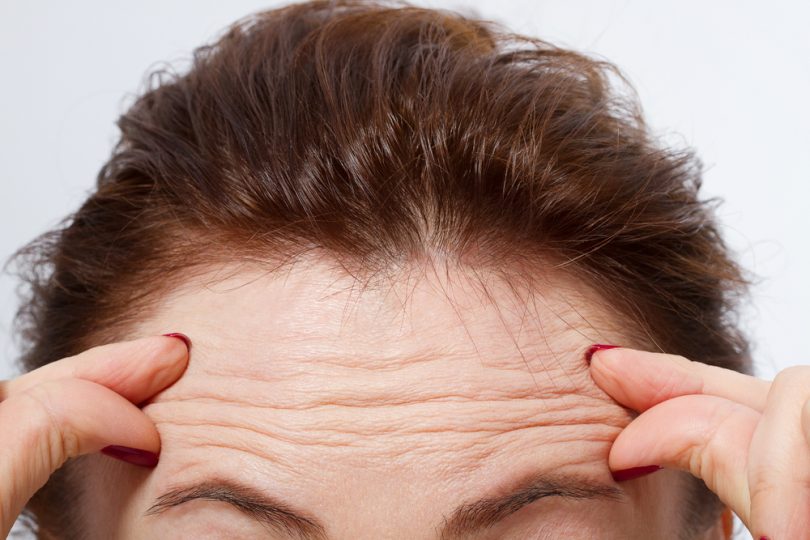 forehead-wrinkles-how-to-get-rid-of-them-women-s-alphabet