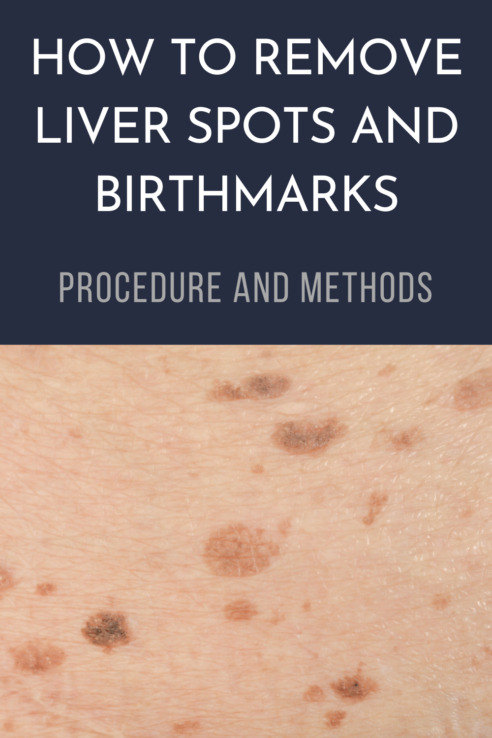 What Are White Spots On Liver Ultrasound - Printable Templates Protal