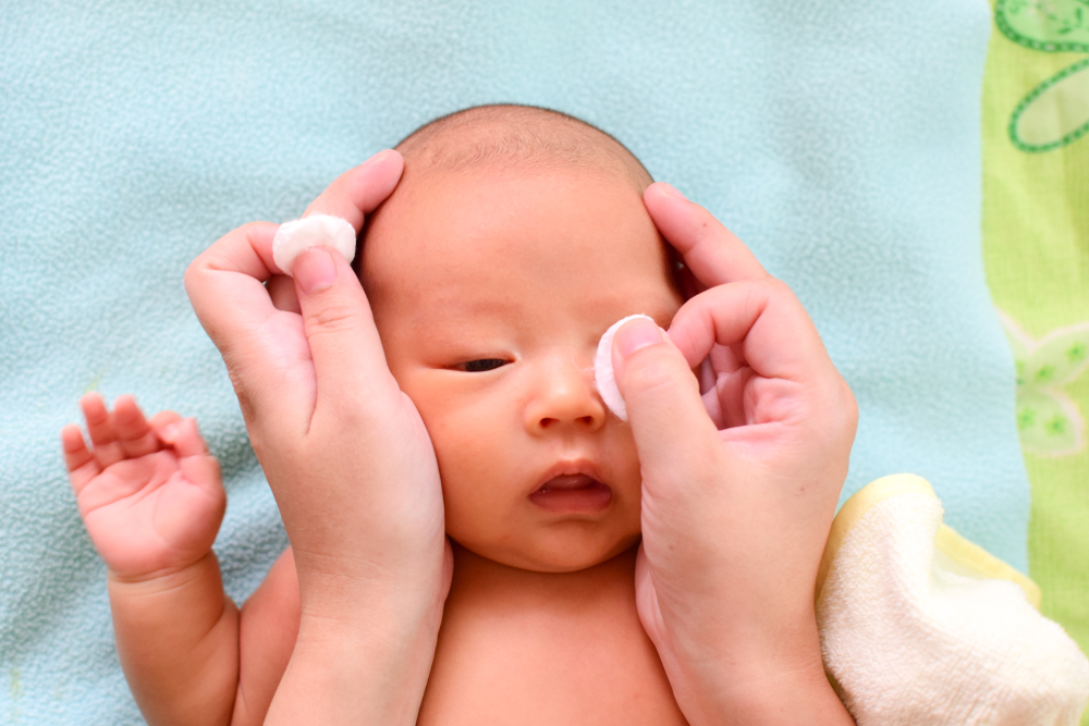 Baby Watery Eyes What Causes Infant Watery Eyes