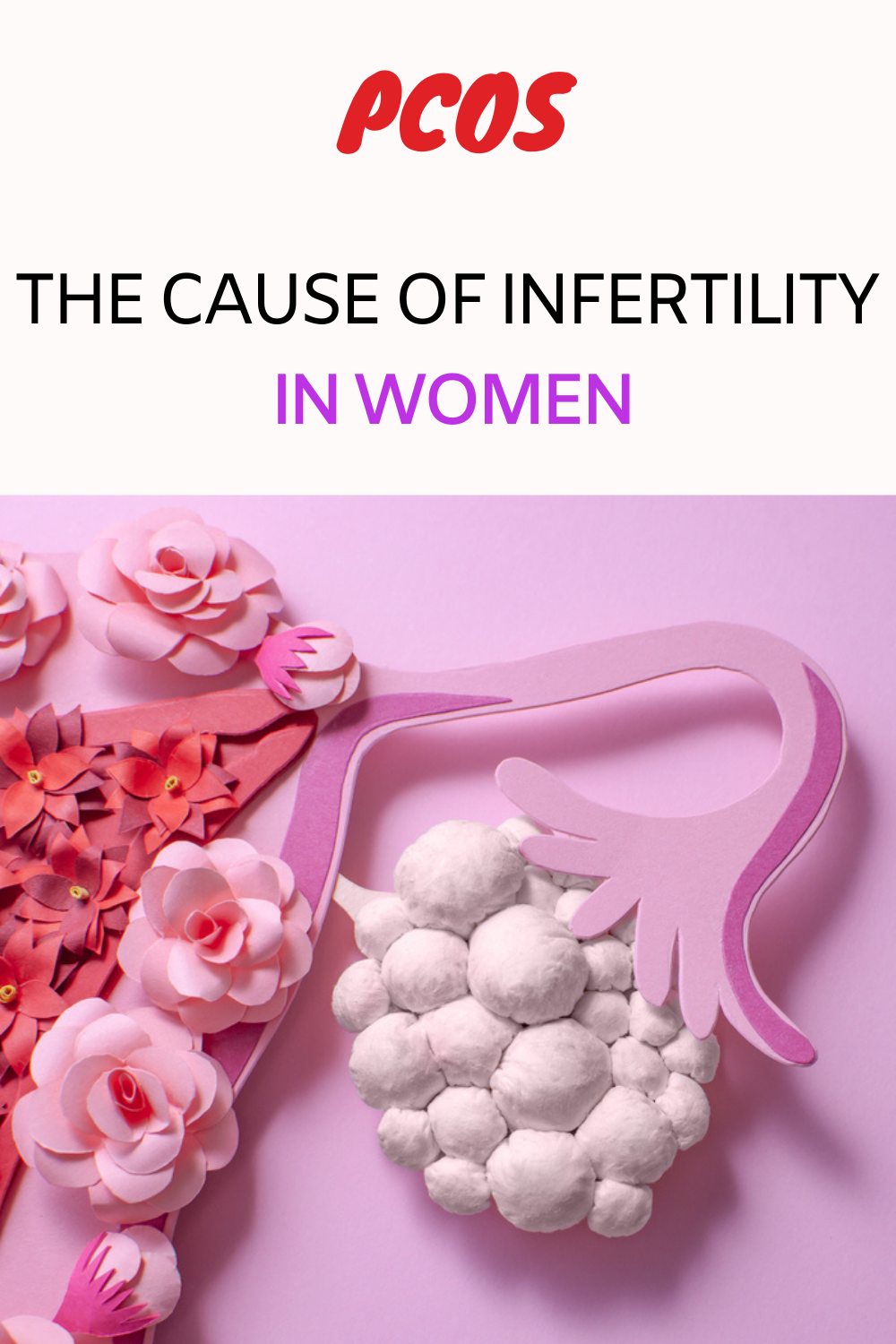 Polycystic Ovary Syndrome Pcos The Cause Of Infertility In Women