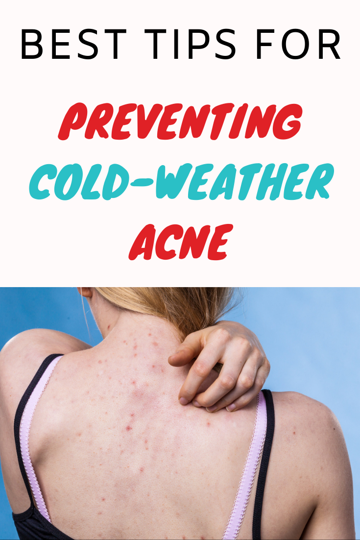 best-tips-for-preventing-cold-weather-acne