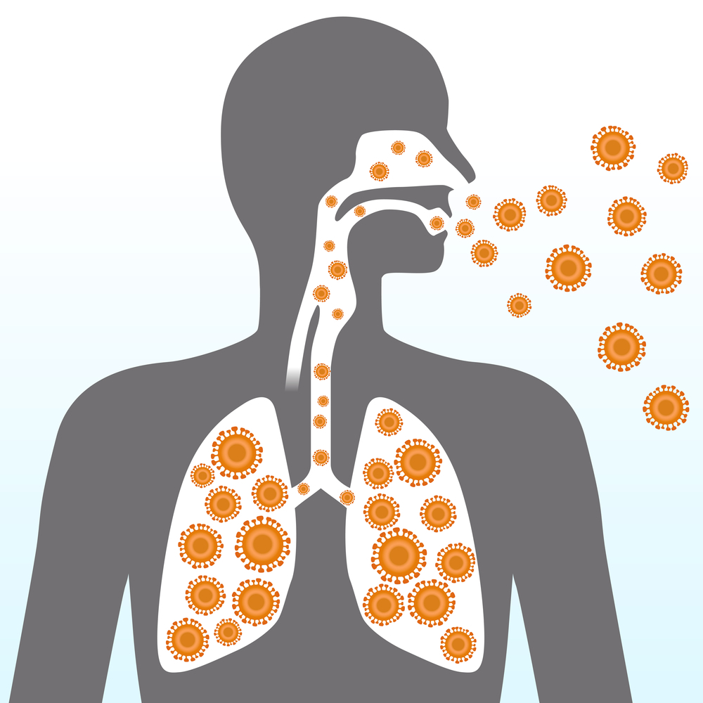 10 Best Home Remedies for Upper Respiratory Tract Infections